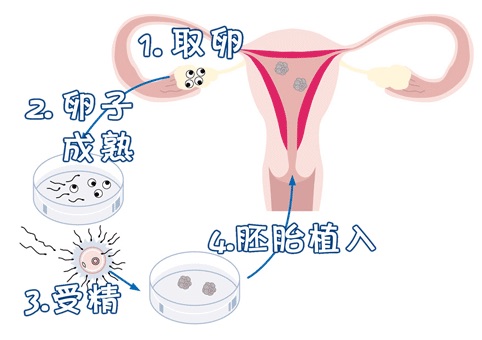 严重少弱精案例